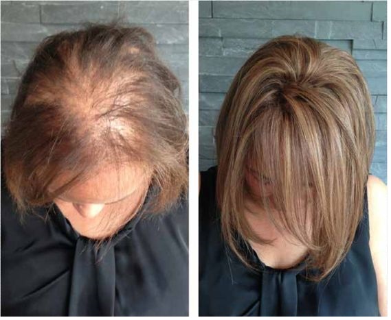 denenmis-sac-gurlestirme