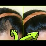 dermatolog-sac-gurlestirme