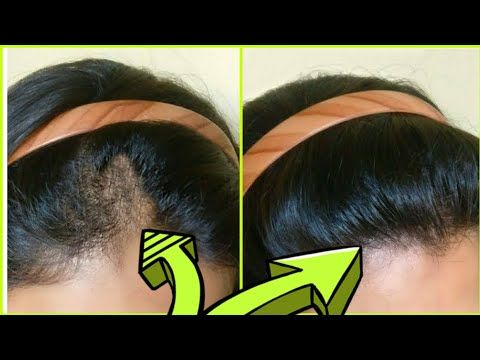 dermatolog-sac-gurlestirme