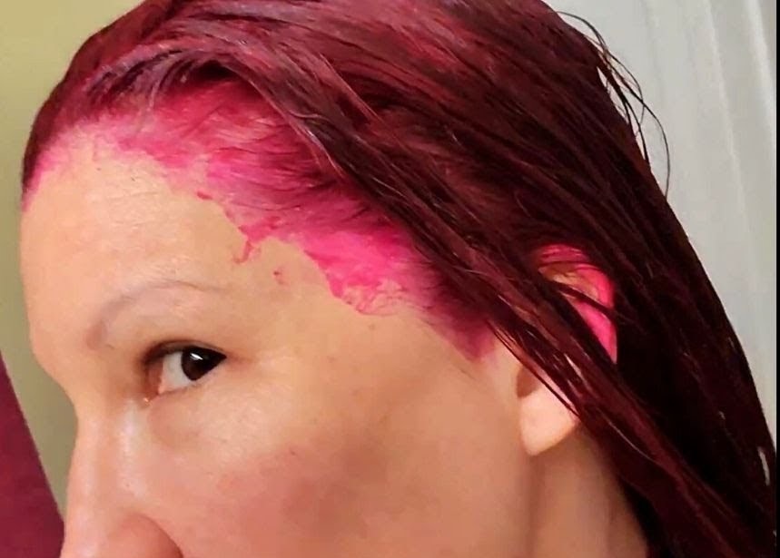 alindaki-sac-boyasi-nasil-cikar