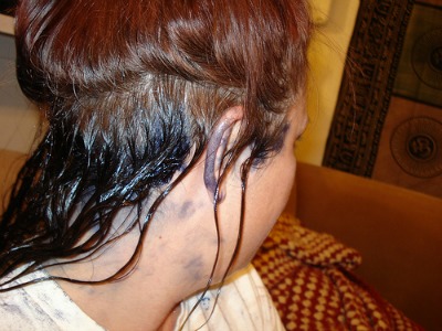 sac-boyasi-tenden-nasil-cikar