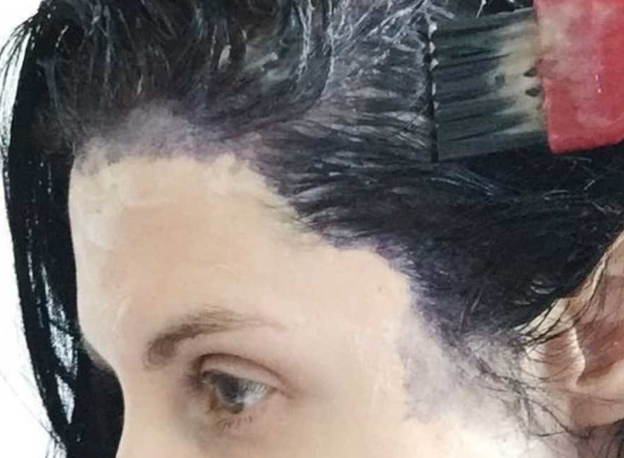 sac-boyasi-vucuttan-nasil-cikar