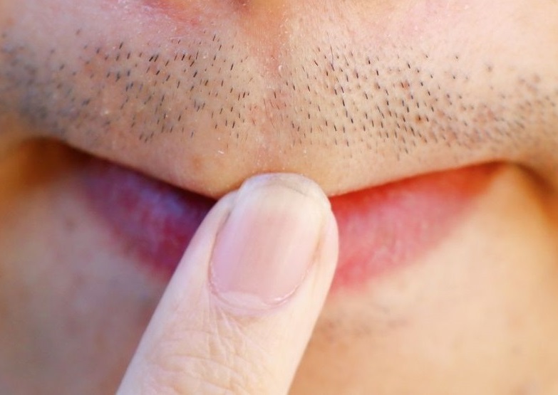 Biyigimin-ortasi-yok