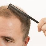 Tepede saç dökülmesi olan erkek için kısa saç modelleri